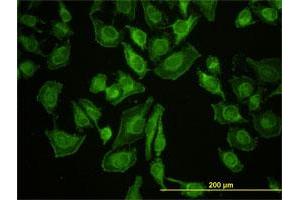 Immunofluorescence of monoclonal antibody to LETM1 on HeLa cell.