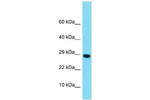 Western Blotting (WB) image for anti-H2B Histone Family, Member M (H2BFM) (Middle Region) antibody (ABIN2774481) (H2bfm anticorps  (Middle Region))