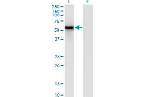 Western Blot analysis of IRF3 expression in transfected 293T cell line by IRF3 monoclonal antibody (M10), clone 3C8.