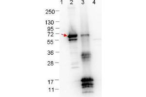 Western blot showing detection of 0. (ErpN/OspE anticorps)