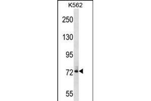anti-Dynein, Axonemal, Intermediate Chain 1 (DNAI1) (AA 92-120), (N-Term) antibody