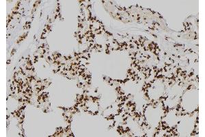 ABIN6273541 at 1/100 staining Rat lung tissue by IHC-P. (JMJD2D anticorps  (N-Term))