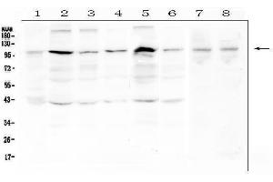 Western blot analysis of RSK3 using anti-RSK3 antibody (ABIN6719360).