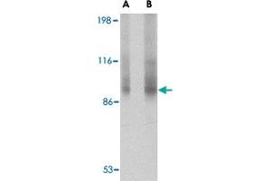 Western blot analysis of TNPO3 in rat liver tissue lysate with TNPO3 polyclonal antibody  at (A) 1 and (B) 2 ug/mL . (Transportin 3 anticorps  (N-Term))