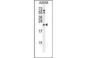 western blot analysis  of RAB10 Antibody (Center) in A2058 cell line lysates (35ug/lane).