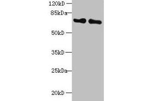 Western blot All lanes: KEAP1 antibody at 2 μg/mL Lane 1: Mouse kidney tissue Lane 2: NIH/3T3 whole cell lysate Secondary Goat polyclonal to rabbit IgG at 1/10000 dilution Predicted band size: 70 kDa Observed band size: 70 kDa (KEAP1 anticorps  (AA 1-624))