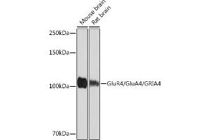 Western blot analysis of extracts of various cell lines, using GluR4/Glu/GRIRabbit mAb (593) at 1:1000 dilution. (GRIA4 anticorps)