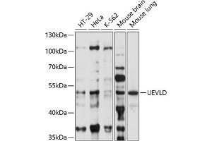 Western blot analysis of extracts of various cell lines, using UEVLD antibody (ABIN7271212) at 1:1000 dilution. (UEVLD anticorps  (AA 50-190))