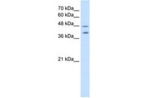 Image no. 1 for anti-Pregnancy Specific beta-1-Glycoprotein 1 (PSG1) (AA 351-400) antibody (ABIN204993) (PSG1 anticorps  (AA 351-400))