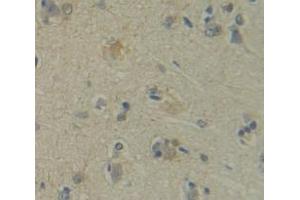 IHC-P analysis of Human Tissue, with DAB staining. (DVL3 anticorps  (AA 545-716))