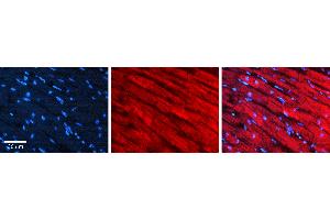 Rabbit Anti-SREBF2 Antibody   Formalin Fixed Paraffin Embedded Tissue: Human heart Tissue Observed Staining: Cytoplasmic in golgi Primary Antibody Concentration: 1:100 Other Working Concentrations: 1:600 Secondary Antibody: Donkey anti-Rabbit-Cy3 Secondary Antibody Concentration: 1:200 Magnification: 20X Exposure Time: 0.