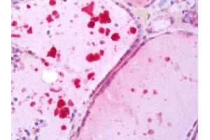 Human Thyroid: Formalin-Fixed, Paraffin-Embedded (FFPE) (TSH receptor anticorps  (N-Term))