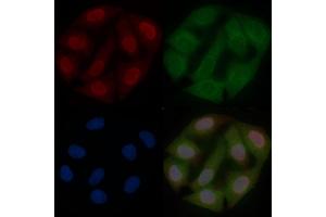 Phospho-FOXO1A (Ser329) Mouse Monoclonal Antibody staining Hela cells by IF/ICC. (FOXO1 anticorps  (pSer329))