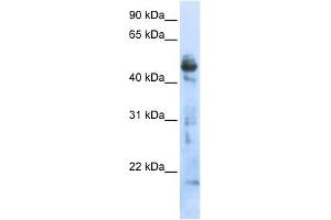 OXSM antibody used at 1 ug/ml to detect target protein.