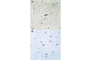 Immunohistochemical staining of human brain tissue by FRS2 (phospho Y436) polyclonal antibody  without blocking peptide (A) or preincubated with blocking peptide (B) under 1:50-1:100 dilution. (FRS2 anticorps  (pTyr436))