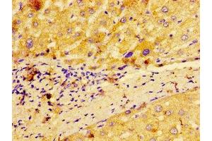 anti-Metastasis Associated in Colon Cancer 1 (MACC1) (AA 371-514) antibody