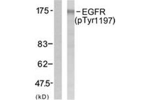 Western blot analysis of extracts from A431 cells treated with EGF 40 muM 10', using EGFR (Phospho-Tyr1197) Antibody. (EGFR anticorps  (pTyr1197))