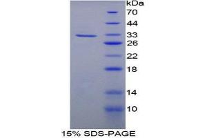 SDS-PAGE (SDS) image for Fatty Acid Synthase (FASN) (AA 2243-2505) protein (His tag) (ABIN2124782)
