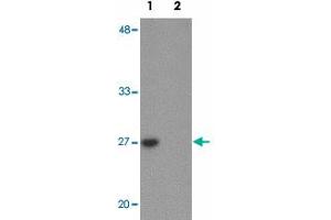 Western blot analysis of TMEM59 in human kidney tissue lysate with TMEM59 polyclonal antibody  at 1 ug/mL in (1) the absence and (2) the presence of blocking peptide. (TMEM59 anticorps  (N-Term))