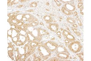 Immunohistochemistry (IHC) image for anti-Ubiquitin Protein Ligase E3 Component N-Recognin 4 (UBR4) (AA 1350-1400) antibody (ABIN7454815)
