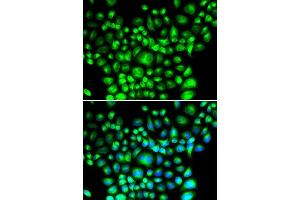 Immunofluorescence analysis of U2OS cells using BCAP31 antibody. (BCAP31 anticorps  (AA 127-246))