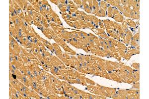 ABIN7093234 and ABIN7097246 at 1/100 staining Rat heart tissue by IHC-P. (SOD2 anticorps  (acLys68))