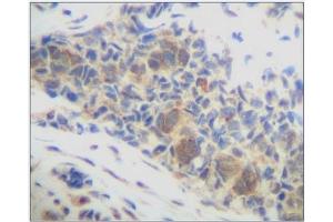 Image no. 3 for anti-Chemokine (C-X-C Motif) Ligand 14 (CXCL14) antibody (ABIN181664) (CXCL14 anticorps)