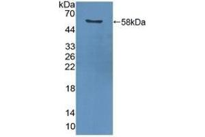 Detection of Recombinant PCNA using Polyclonal Antibody to Proliferating Cell Nuclear Antigen (PCNA) (PCNA anticorps  (AA 6-261))