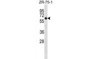 Western Blotting (WB) image for anti-Arylsulfatase D (ARSD) antibody (ABIN2998905)