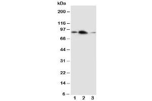 Western blot testing of APLP2 antibody and Lane 1:  rat brain (APLP2 anticorps  (C-Term))