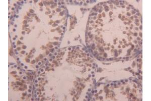 DAB staining on IHC-P; Samples: Mouse Testis Tissue (ACVR1 anticorps  (AA 208-340))