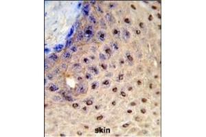 Formalin-fixed and raffin-embedded human skin reacted with X3 Antibody (N-term), which was peroxidase-conjugated to the secondary antibody, followed by DAB staining. (Paired Box 3 anticorps  (N-Term))