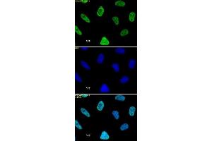 Histone H3 acetyl Lys27 mAb tested by immunofluorescence. (Histone 3 anticorps  (H3K27ac))
