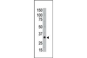 Image no. 1 for anti-Melanoma Antigen Family A, 6 (MAGEA6) (C-Term) antibody (ABIN358649) (MAGEA6 anticorps  (C-Term))