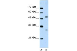 Western Blotting (WB) image for anti-Interferon Regulatory Factor 6 (IRF6) antibody (ABIN2462721) (IRF6 anticorps)