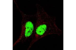 Fluorescent confocal image of SY5Y cells stained with phospho-Sox2-  antibody. (SOX2 anticorps  (pSer246))