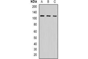 Western blot analysis of p115 expression in BT474 (A), K562 (B), A549 (C) whole cell lysates. (ARHGAP4 anticorps)