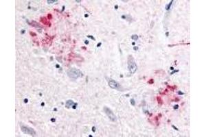 Immunohistochemistry of APP in human brain (Alzheimer’s disease) tissue with APP antibody at 10 μg/ml. (APP anticorps)