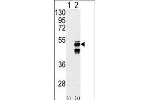 Western blot analysis of M1F (arrow) using M1F Antibody (N-term) (ABIN392883 and ABIN2842287). (PPM1F anticorps  (N-Term))