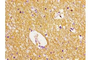 Immunohistochemistry of paraffin-embedded human brain tissue using ABIN7150072 at dilution of 1:100 (DLG2 anticorps  (AA 310-420))
