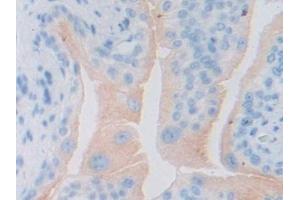 Detection of gp130 in Mouse Testis Tissue using Polyclonal Antibody to Glycoprotein 130 (gp130)