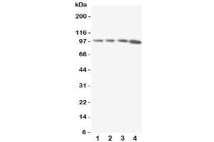 Western blot testing of RIAM antibody and Lane 1:  rat thymus (Amyloid beta (A4) Precursor Protein-Binding, Family B, Member 1 Interacting Protein (APBB1IP) (C-Term) anticorps)