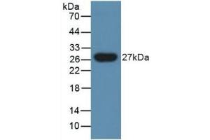 Detection of PGLYRP1 in Human Urine using Polyclonal Antibody to Peptidoglycan Recognition Protein 1 (PGLYRP1) (PGLYRP1 anticorps  (AA 18-183))