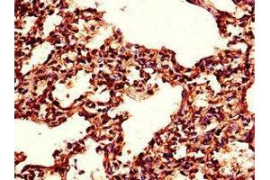Immunohistochemistry of paraffin-embedded human lung tissue using ABIN7173415 at dilution of 1:100 (TPI1 anticorps  (AA 169-228))