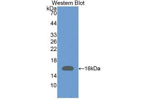 Western blot analysis of the recombinant protein. (VPREB1 anticorps  (AA 33-135))