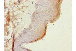 Immunohistochemistry of paraffin-embedded human skin tissue using ABIN7147374 at dilution of 1:100 (CEP57L1 anticorps  (AA 1-167))