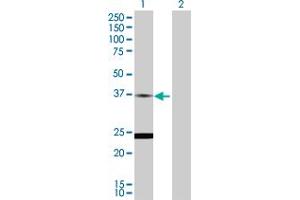 Western Blot analysis of TNNT2 expression in transfected 293T cell line by TNNT2 MaxPab polyclonal antibody. (Cardiac Troponin T2 anticorps  (AA 1-295))