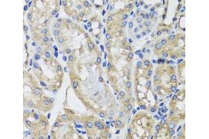 Immunohistochemistry of paraffin-embedded Mouse kidney using MRPS22 Polyclonal Antibody at dilution of 1:100 (40x lens). (MRPS22 anticorps)