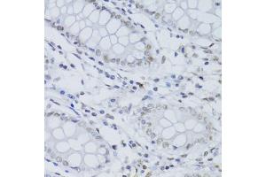 Immunohistochemistry of paraffin-embedded human colon using SNRNP70 antibody (ABIN5973598) at dilution of 1/100 (40x lens). (SNRNP70 anticorps)