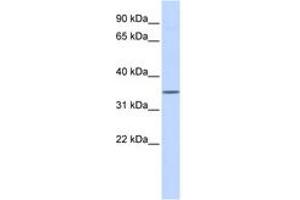 Image no. 1 for anti-Wingless-Type MMTV Integration Site Family, Member 1 (WNT1) (AA 180-229) antibody (ABIN6742252) (WNT1 anticorps  (AA 180-229))